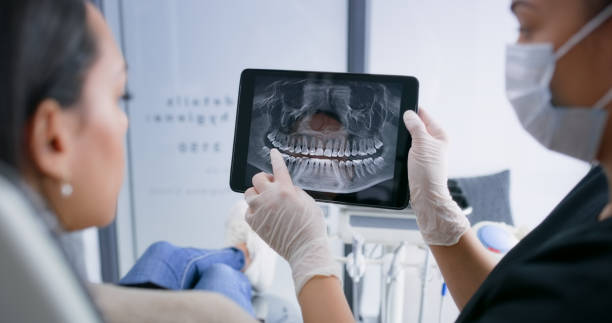 Licensed Tooth Extraction service in New Braunfels, TX - Smile Center Dentistry
